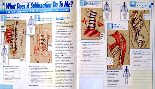 Subluxation Effect