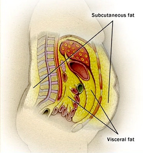 VIsceral Fat Demo